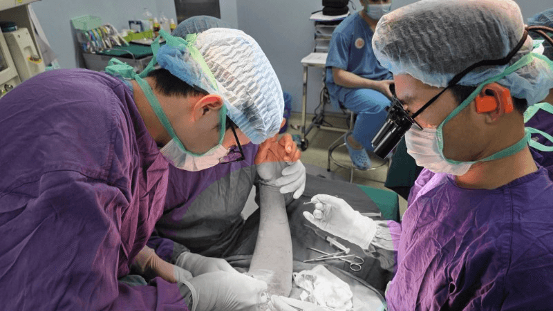 Nối thành công cho bệnh nhân đứt rời 1/3 trên cánh tay